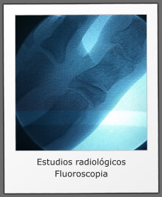 Estudios radiolgicos Fluoroscopia